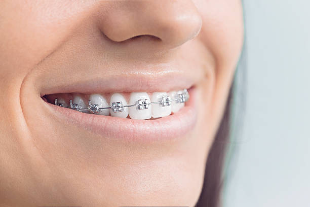 Dental Inlays and Onlays in Rouse, CA